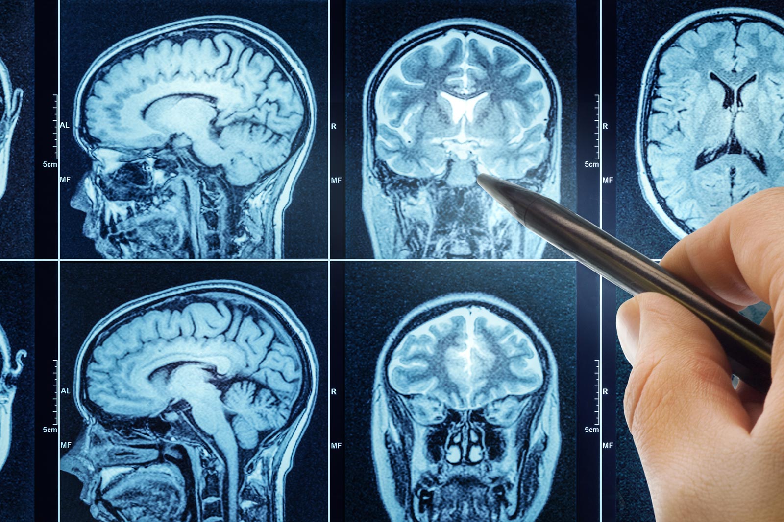 Radiologie-Leinetal-Einbeck-Neurologie-902007128 Radiologie-Leinetal-Einbeck-Neurologische Untersuchungen